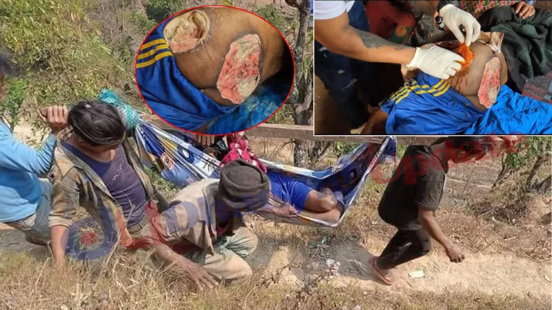दिपबहादुर चेपाङको उपचारमा आर्थिक अभाव, सहयोग गरिदिन परिवारको अपिल