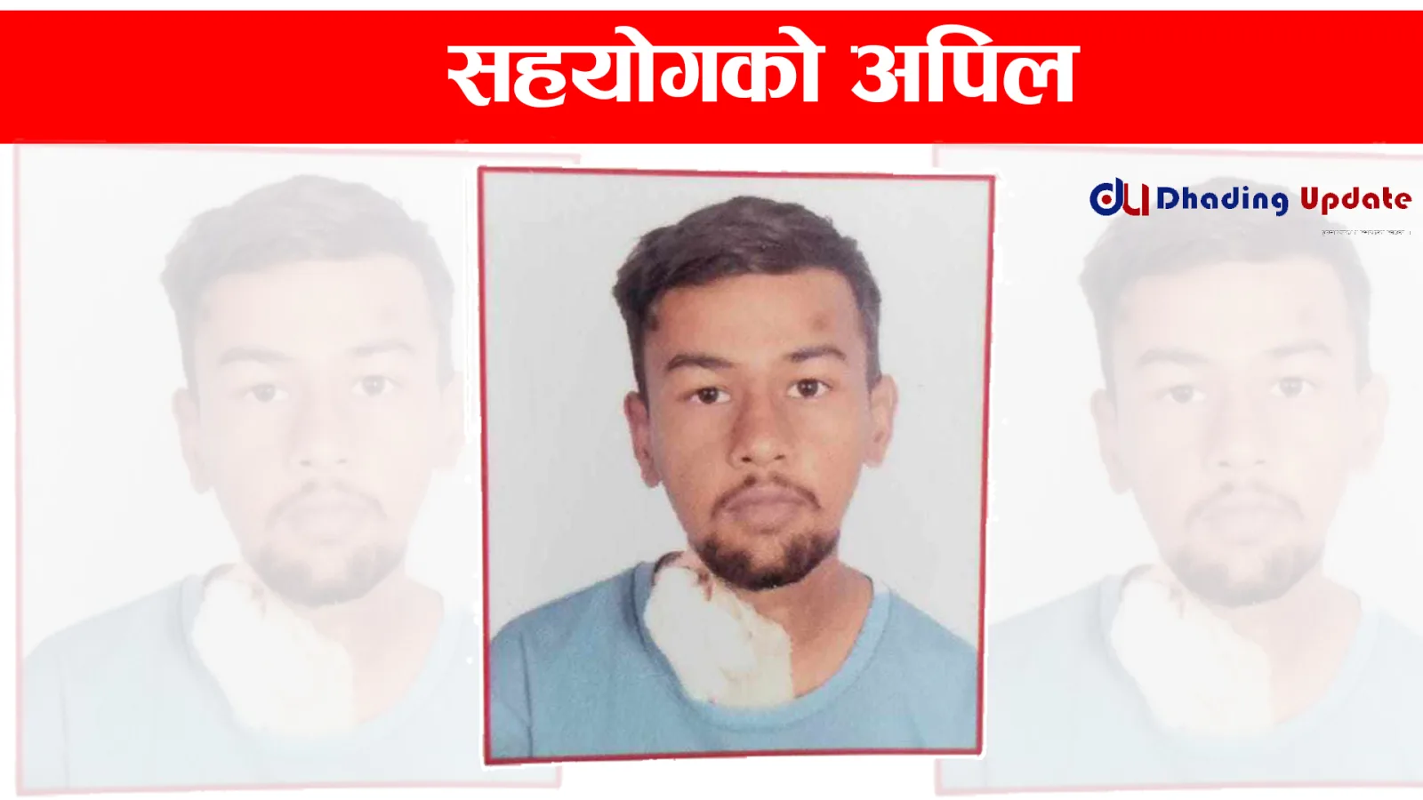 दुबै मृगौला फेल भएपछि सहयोगका याचना