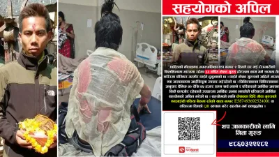 भारतमा होटलमा काम गर्ने क्रममा तेल पोखिएर धादिङका केशव गुरुङ गम्भीर घाइते