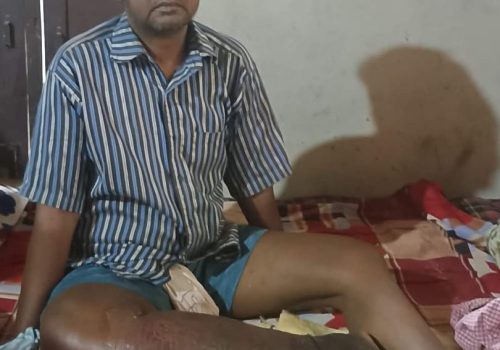 हात्ती पाइले रोगले शिवकुमार मण्डलकाे परिवार बिच्चलीमा